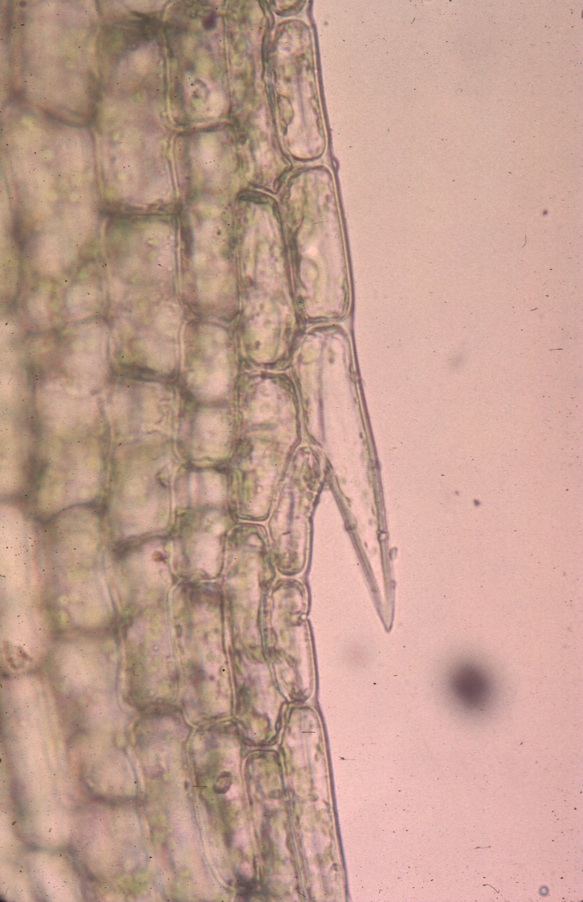 Elodea with spur cell closeup