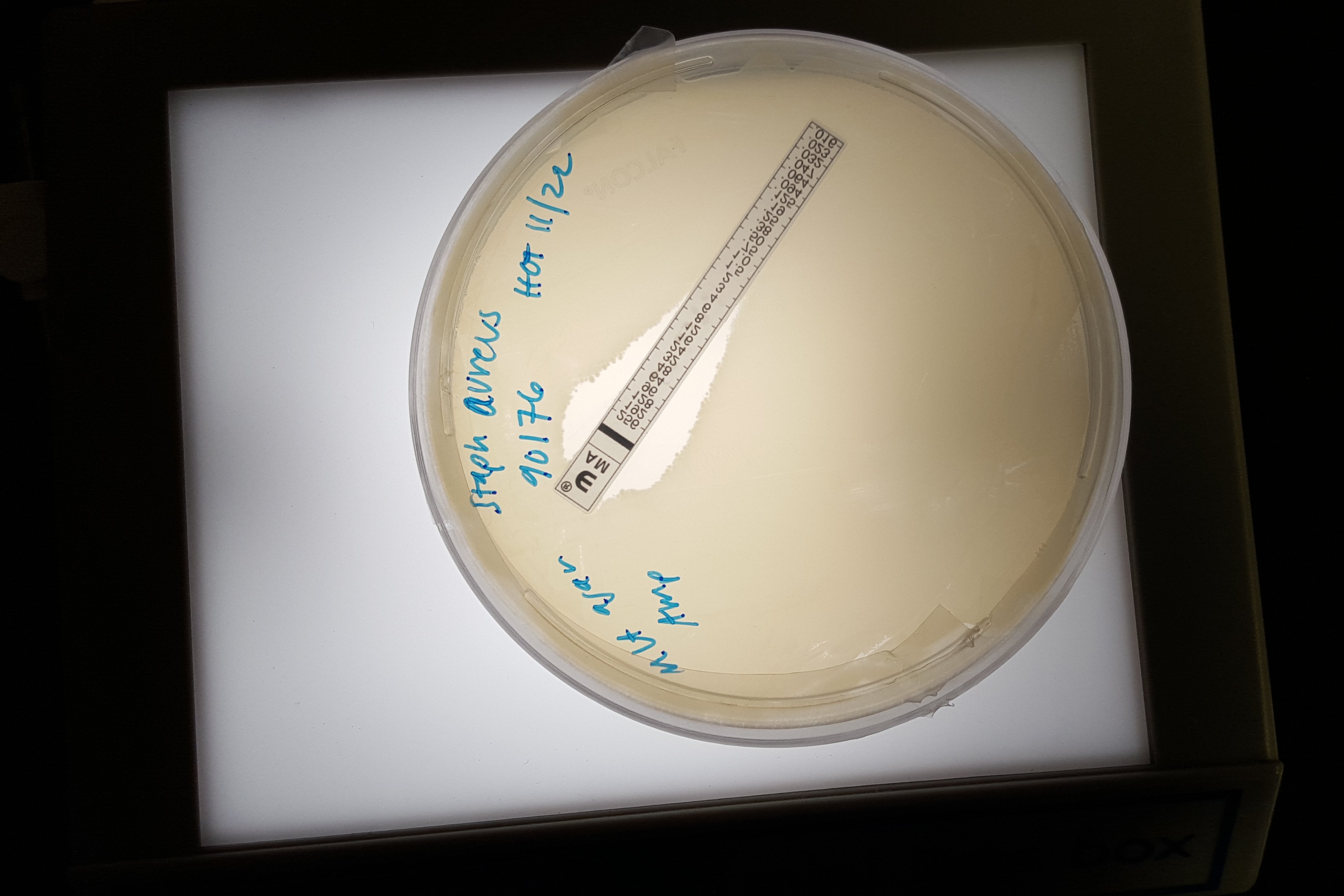 Microfluidicsenabled antibiotic resistance detection Bouwer Research