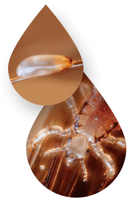 4 dimethicone lotion a subsidised treatment for head lice Best