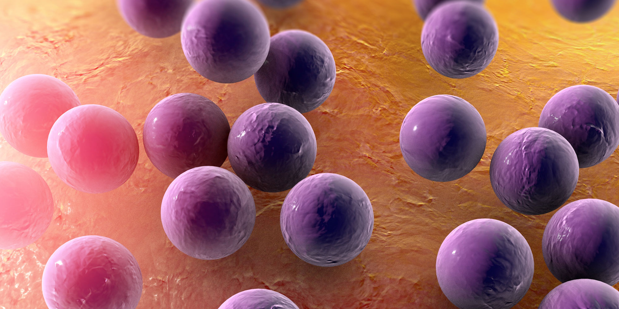 Management of impetigo bpacnz