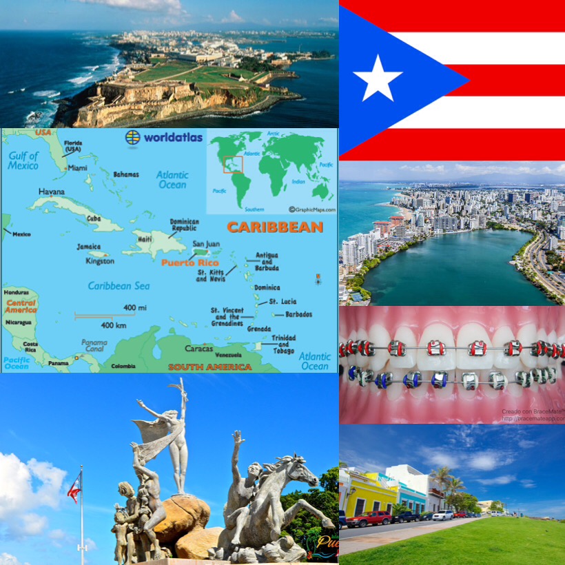 Puerto Rico braces colors EndoPrepApp