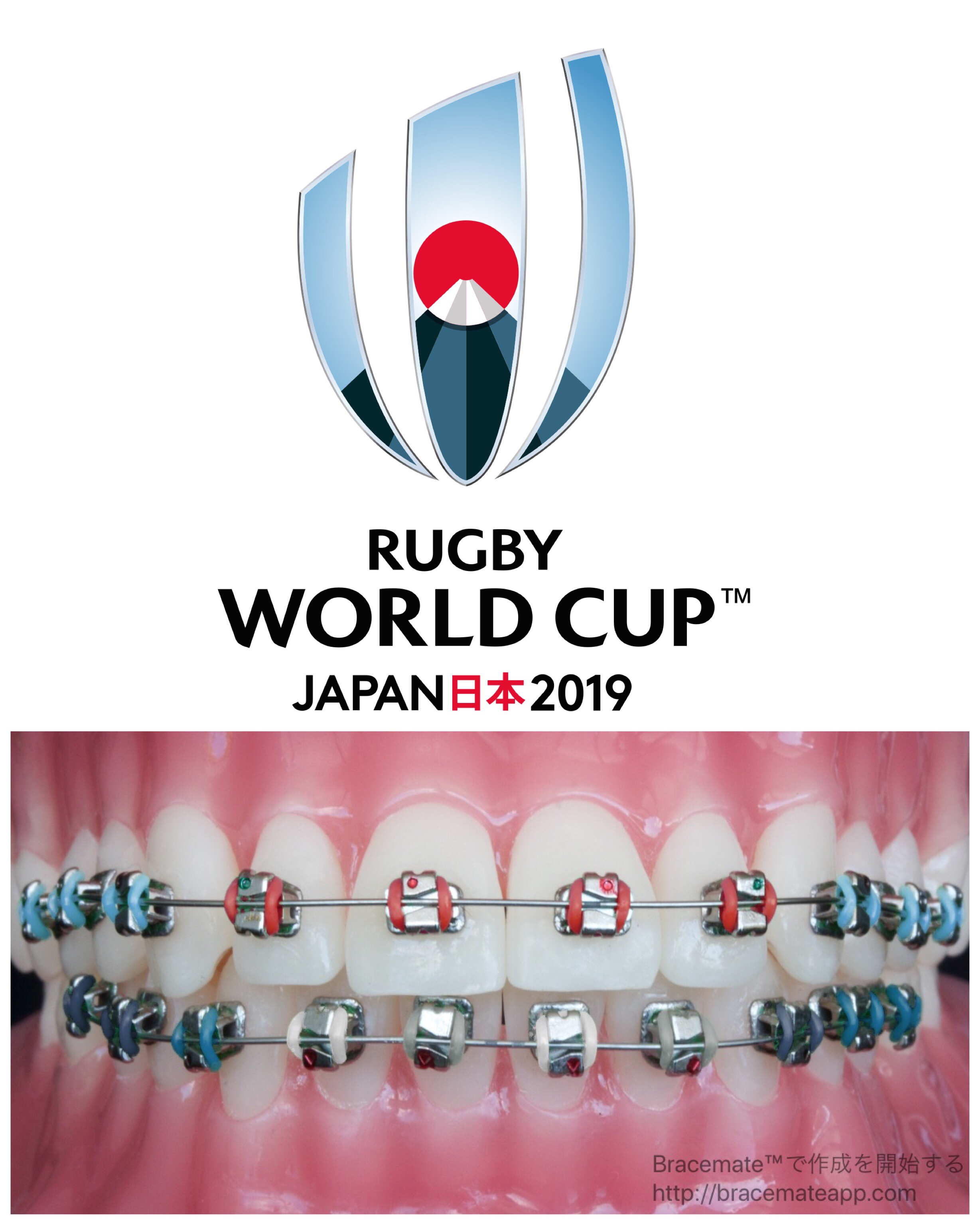 Japan braces colors EndoPrepApp