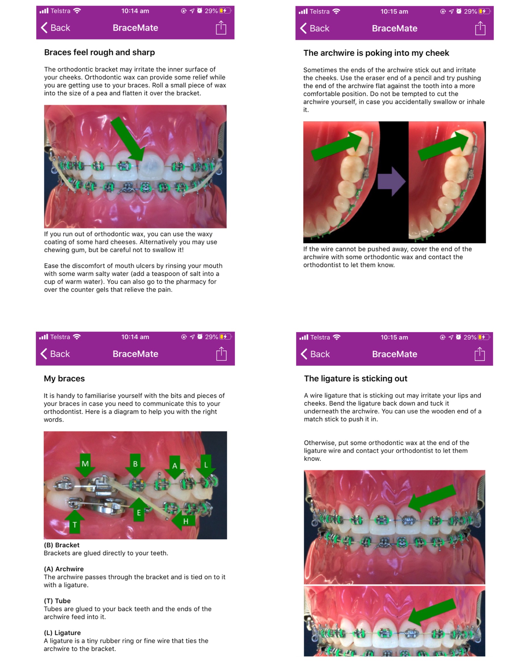Emergency information for braces EndoPrepApp