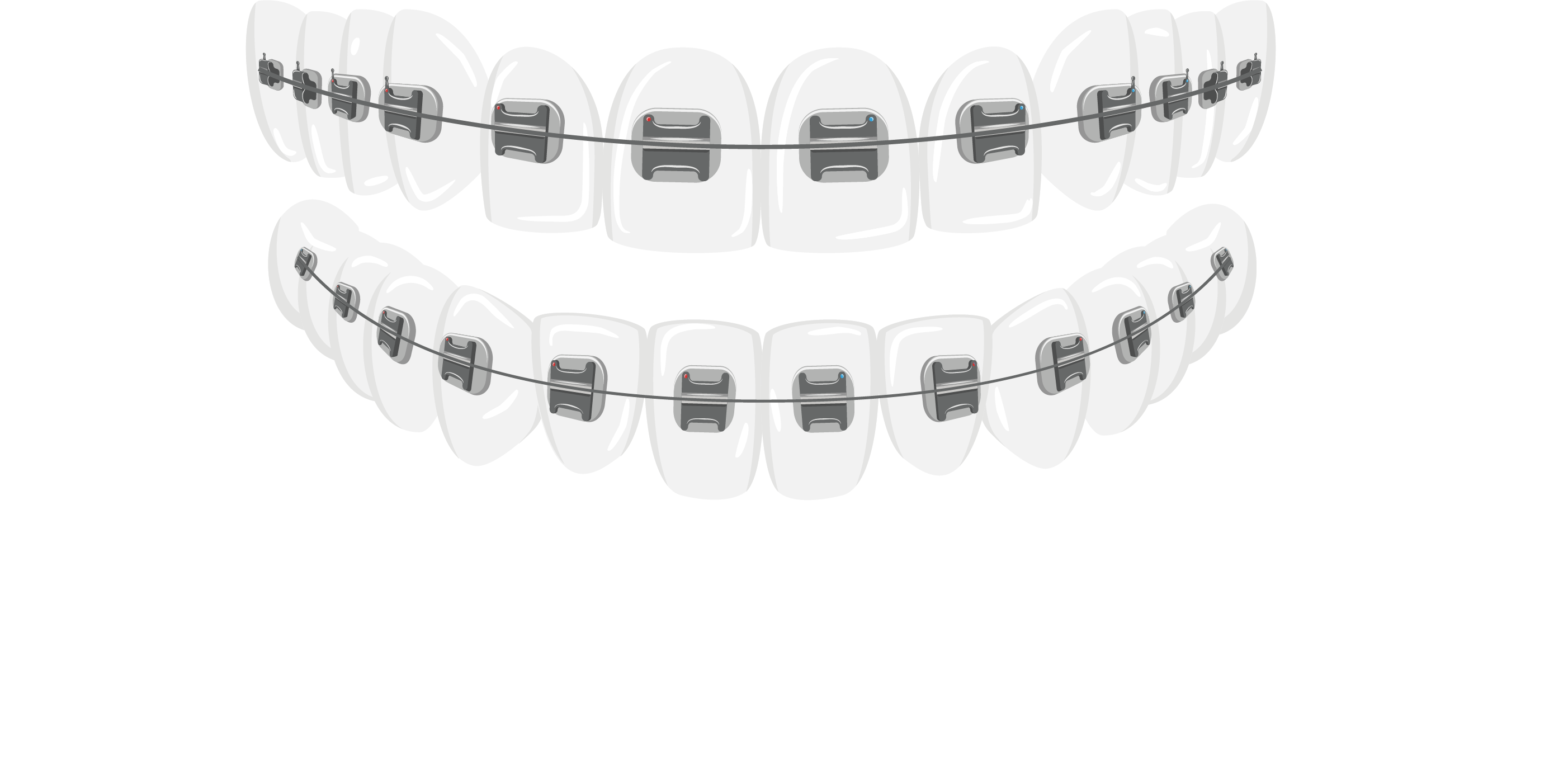 Your Bakersfield Orthodontist Braces4you