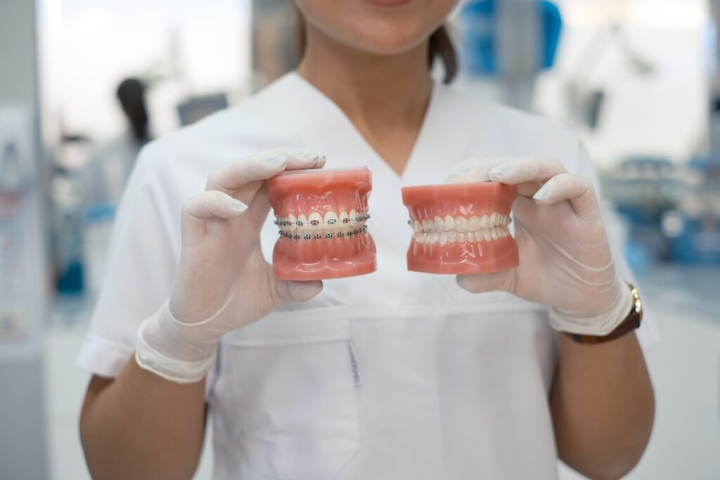 Metal Braces vs Invisalign Which Is Best for You? Central Virginia