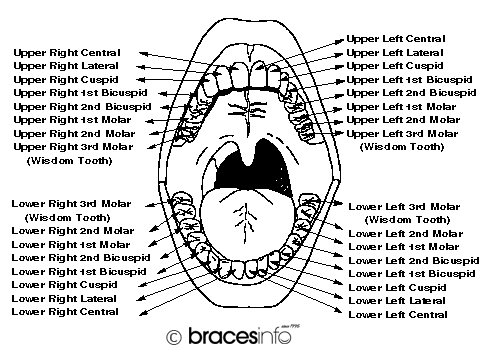 Dental Terms & Braces Terminology