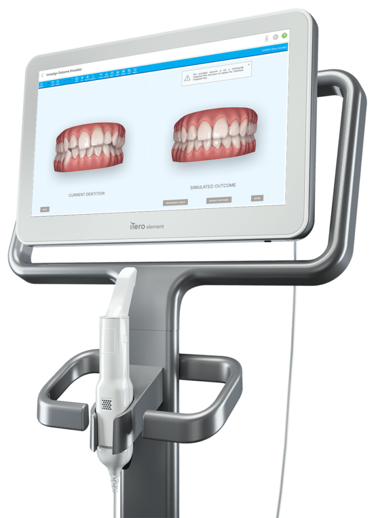 iTero Element 2 Scanner Braces Airdrie Orthodontist Airdrie