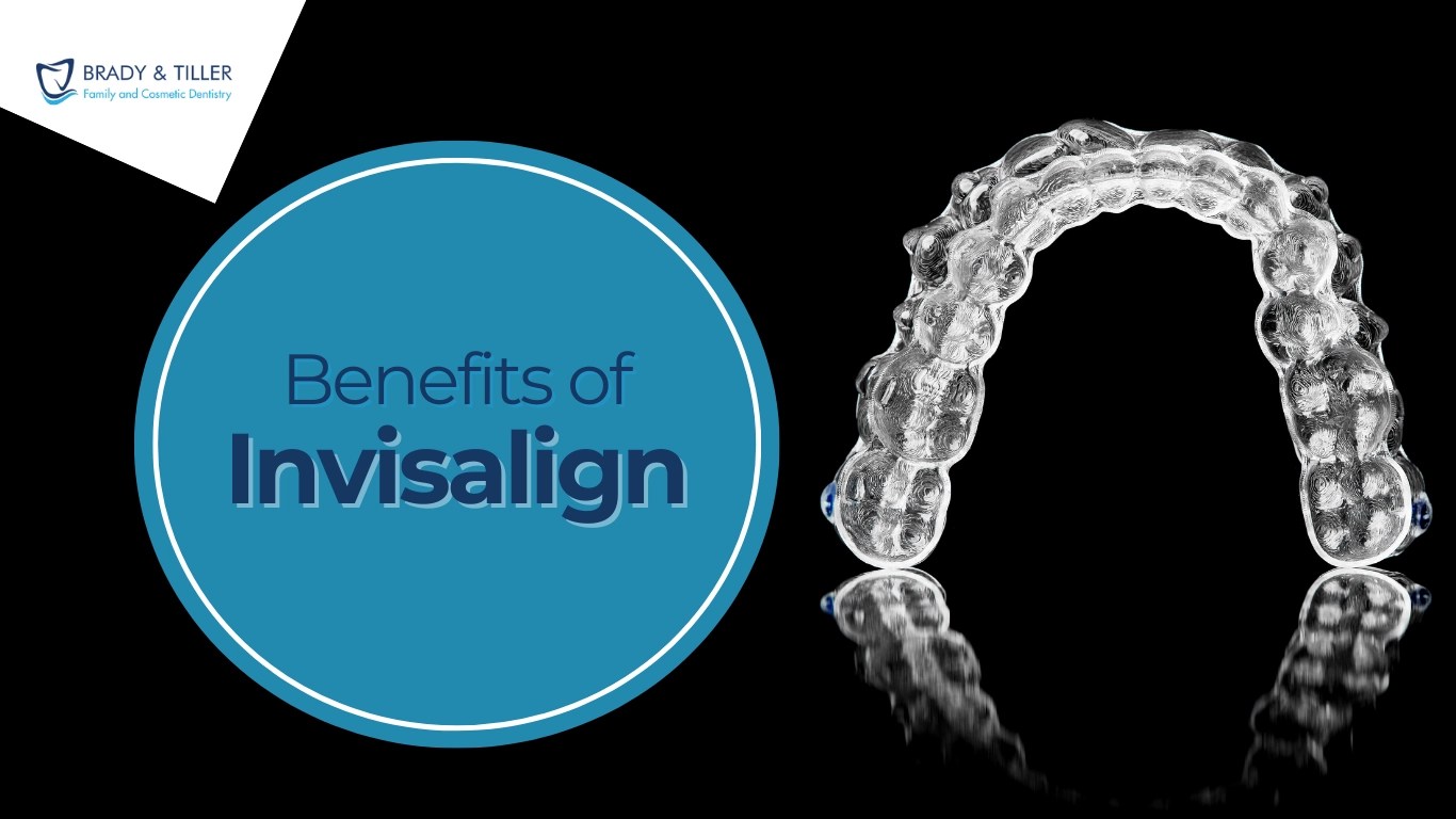 How to Clean Your Invisalign Aligners in Charlotte, NC