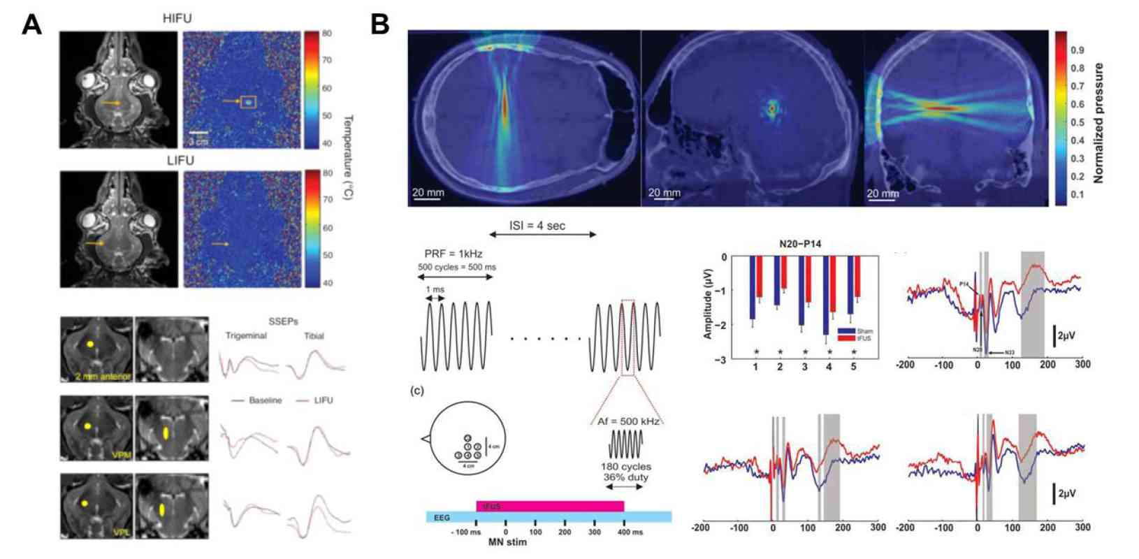 The Mechanisms and Concepts Behind Transcranial Focused Ultrasound