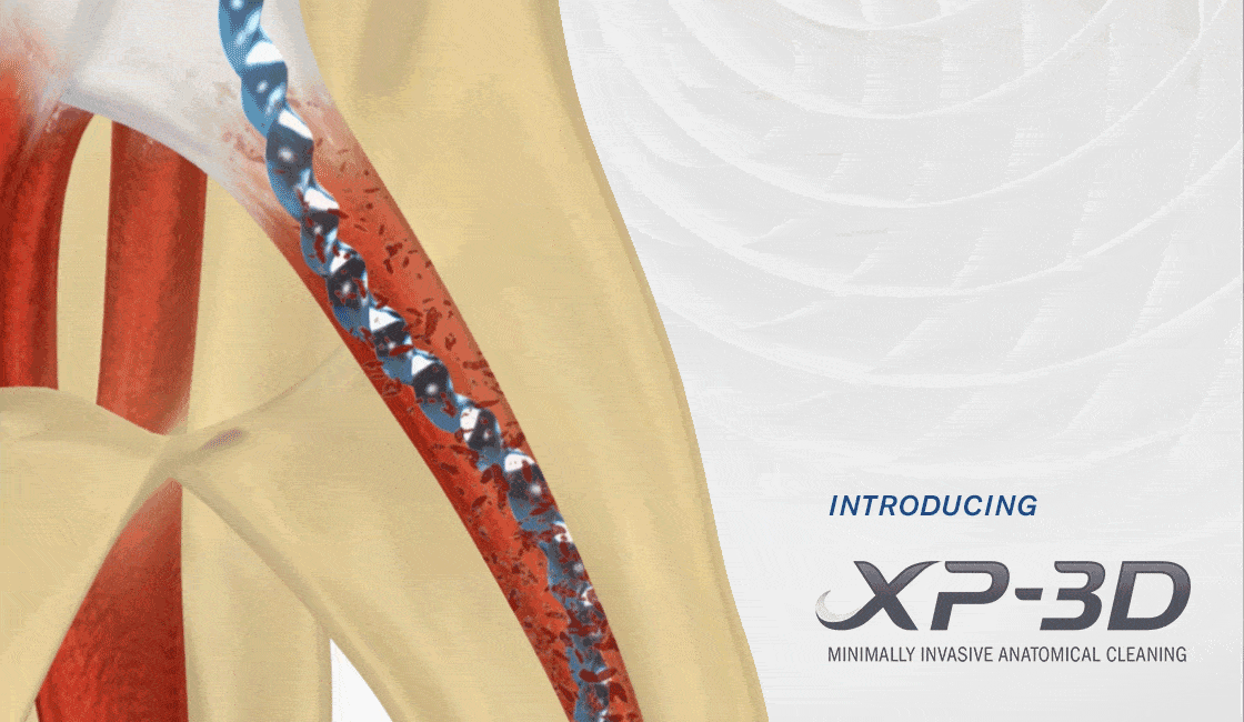 XP3D Introduction by Brasseler USA Brasseler USA Dental