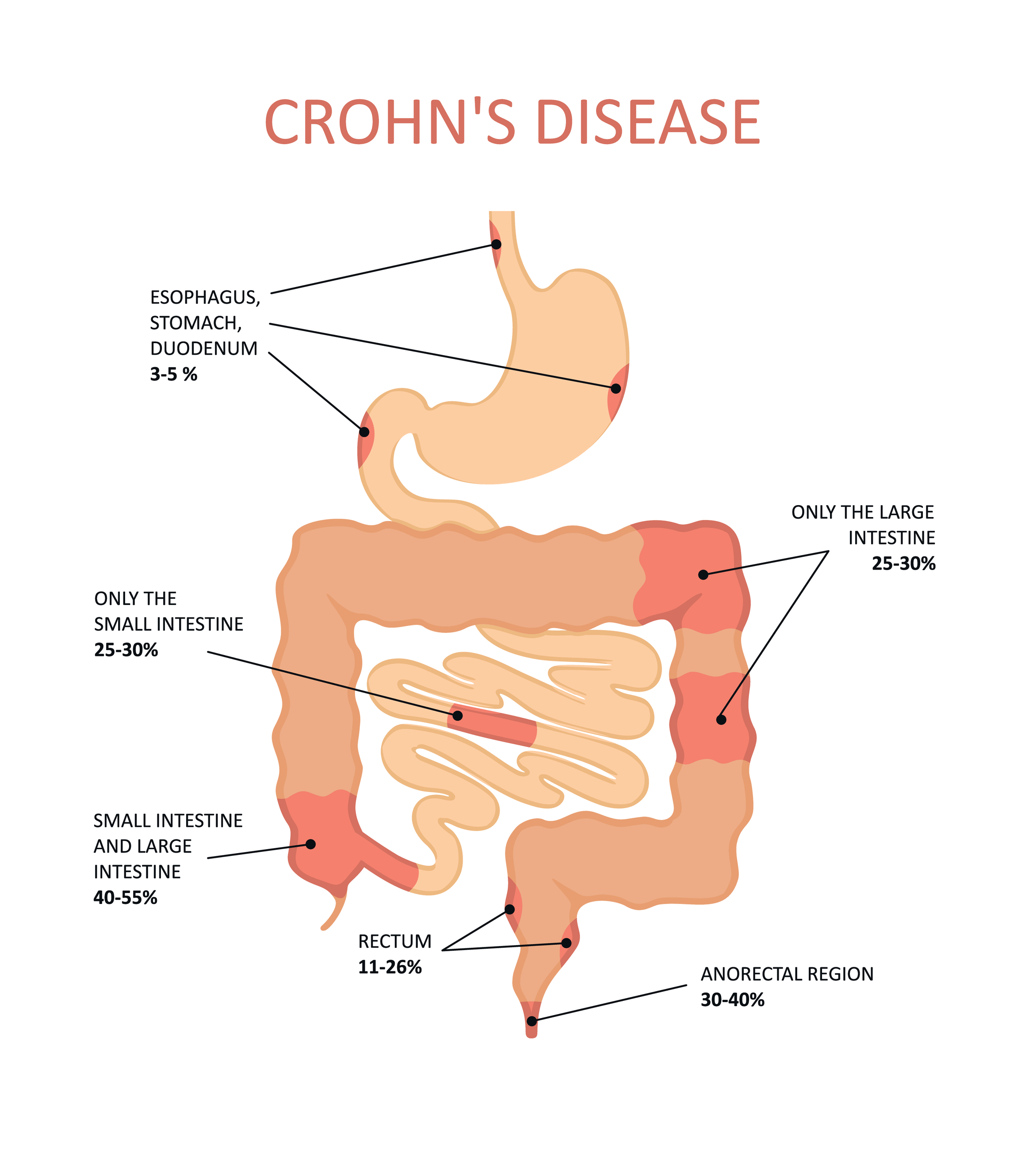 CHRON'S DISEASE