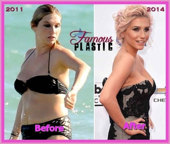 Breast Plastic surgery after weight loss Breast Reduction Surgery
