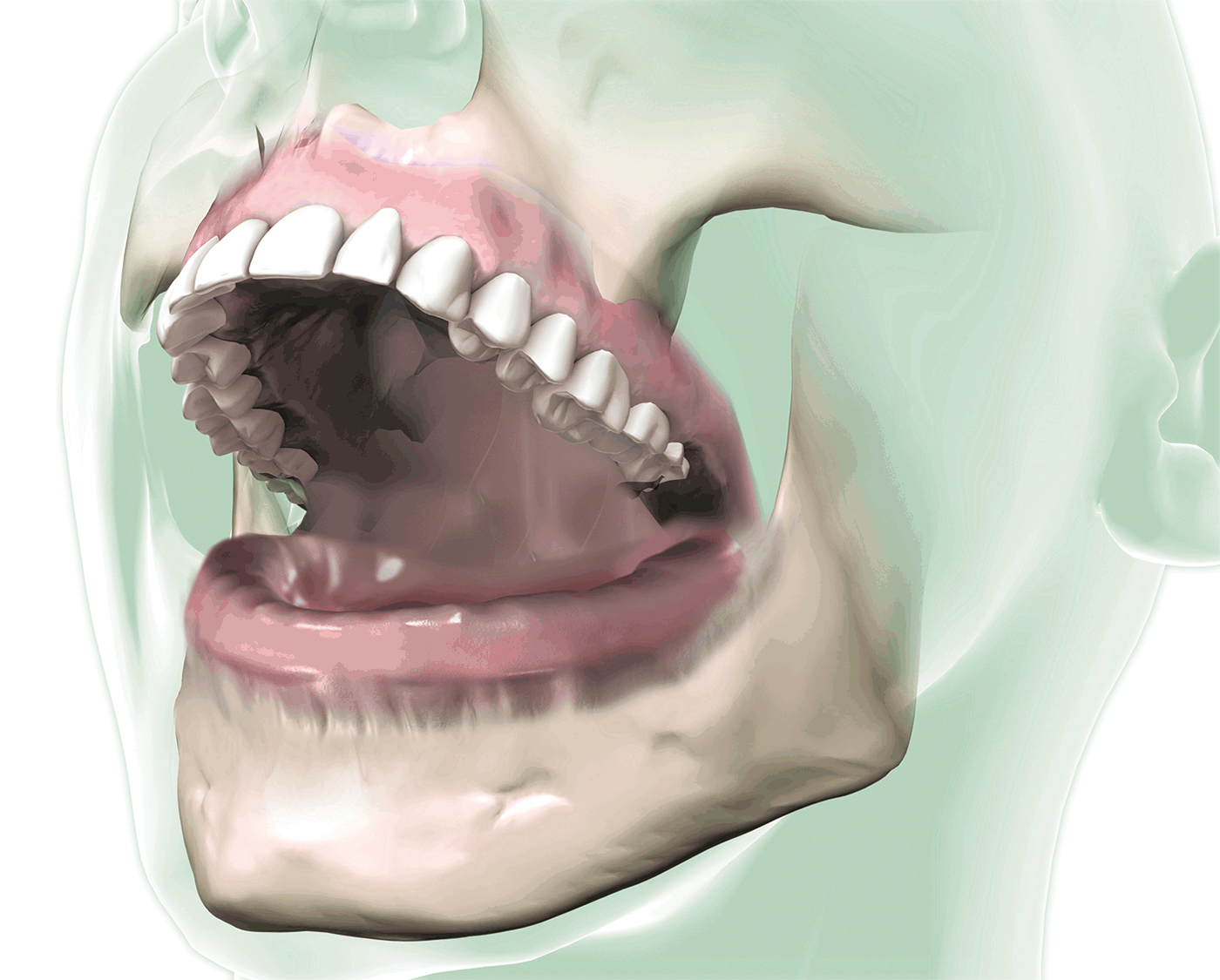 Bredent Canada Dental Medica Supplies in Canada