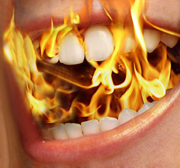 I Burned the Roof of my Mouth and now I wish I was Dead