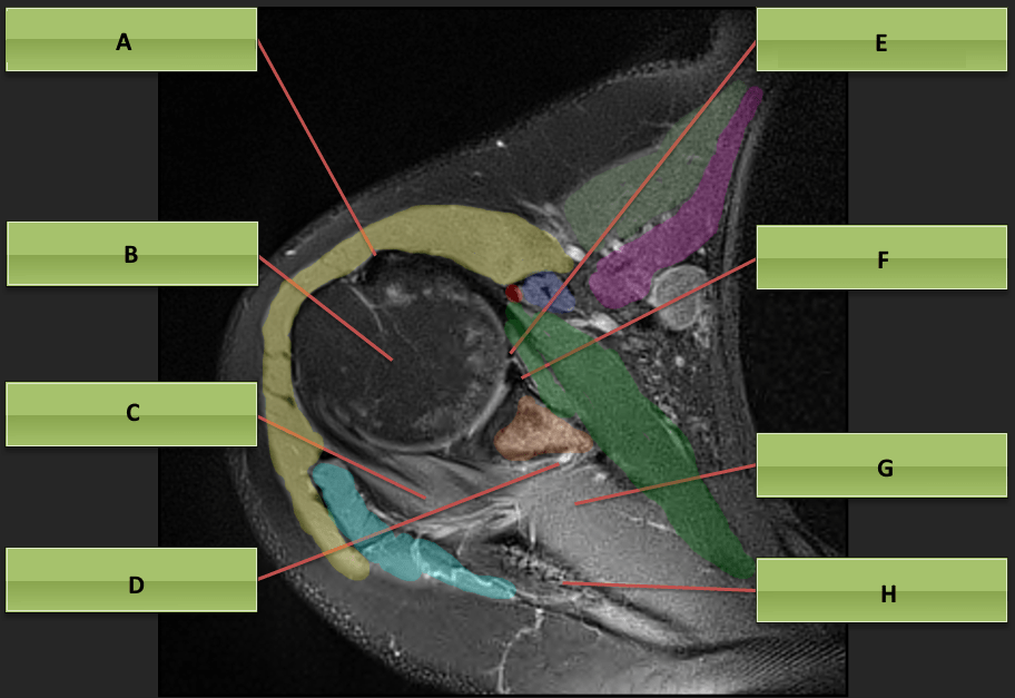 Axial MRI Shoulder Anatomy