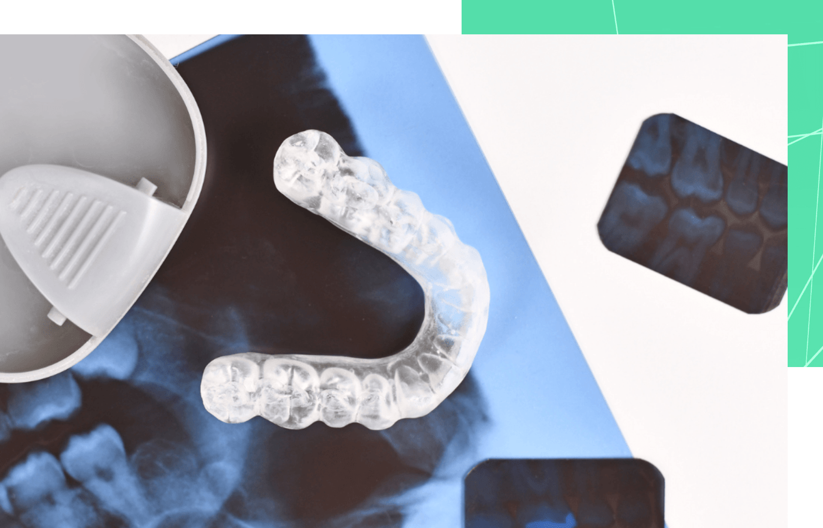 Five Reasons You Should Wear a Night Guard Bright Dentistry