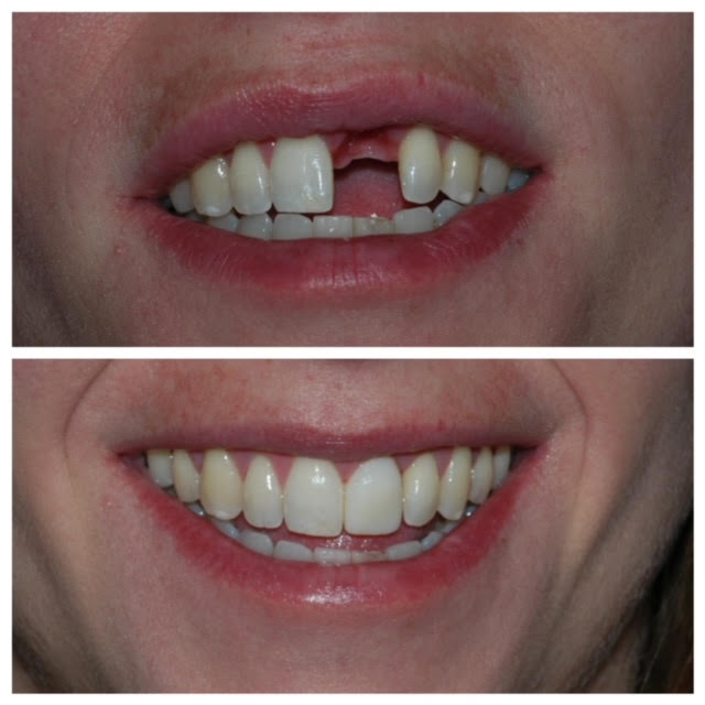 Bright Smiles Cosmetic & Implant Dentistry
