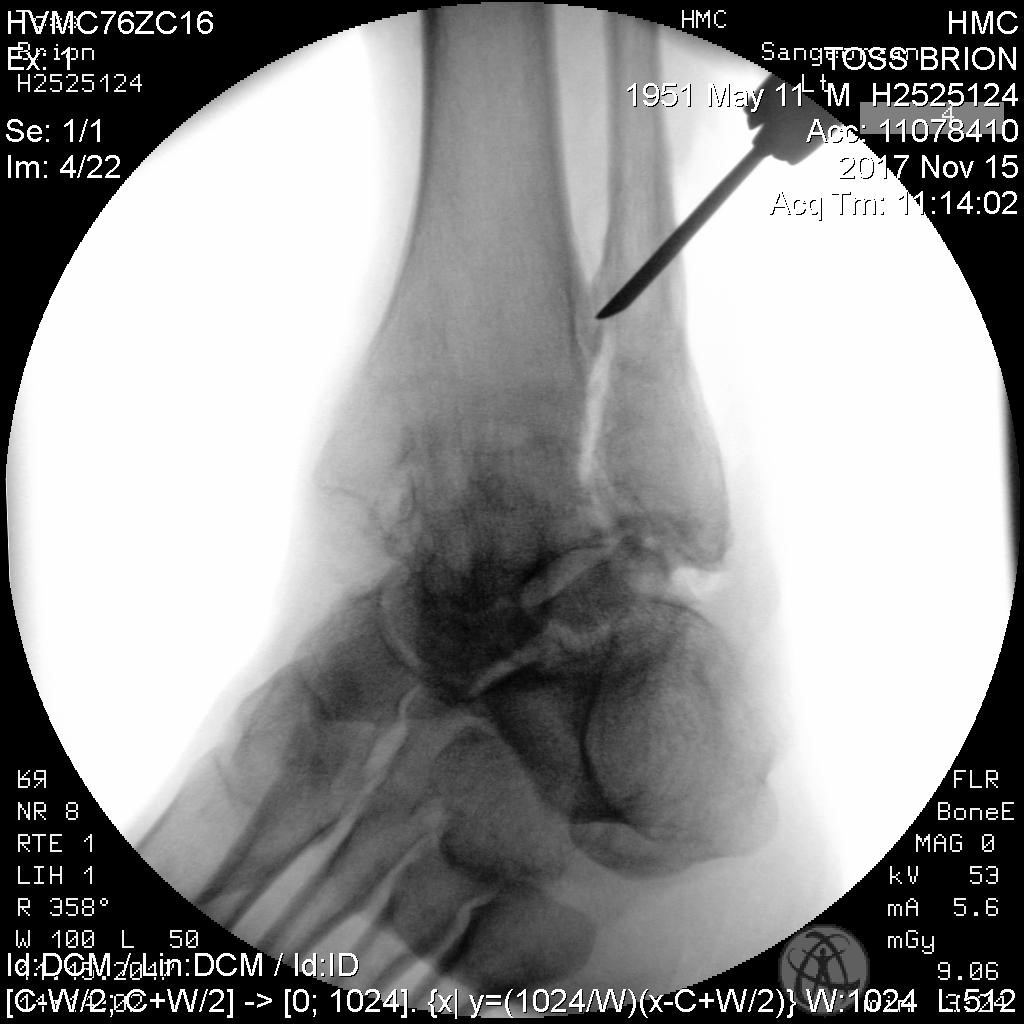 A Mortise and Tendon Joint – Brion Toss Yacht Riggers