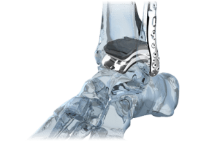 A Mortise and Tendon Joint – Brion Toss Yacht Riggers