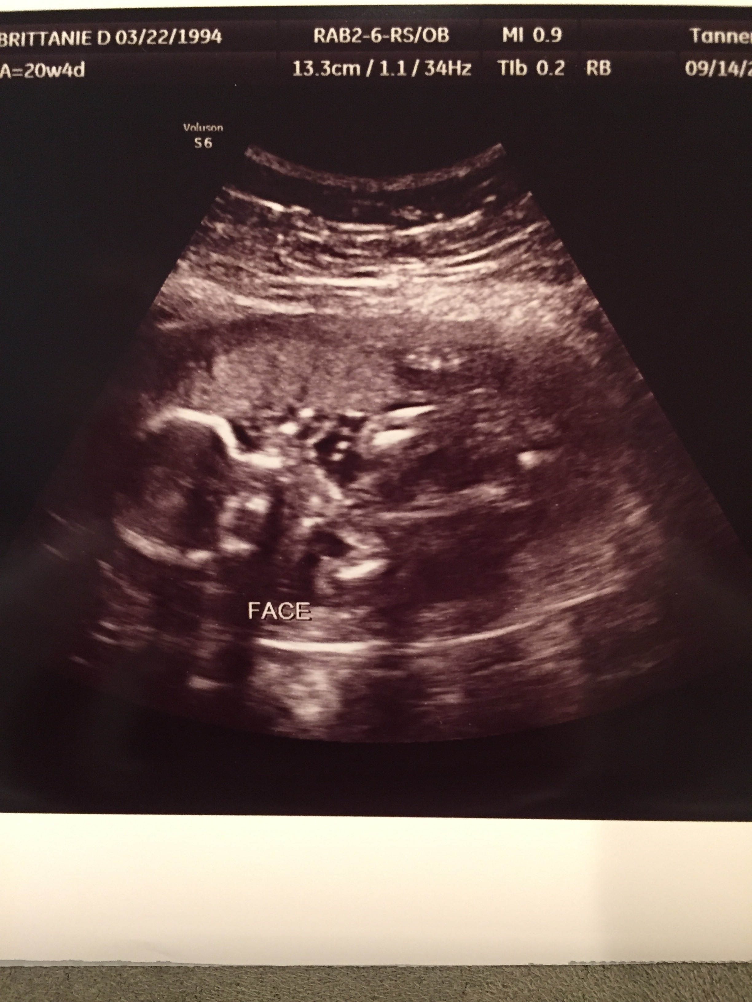 20 Week Ultrasound BrittanieDawn