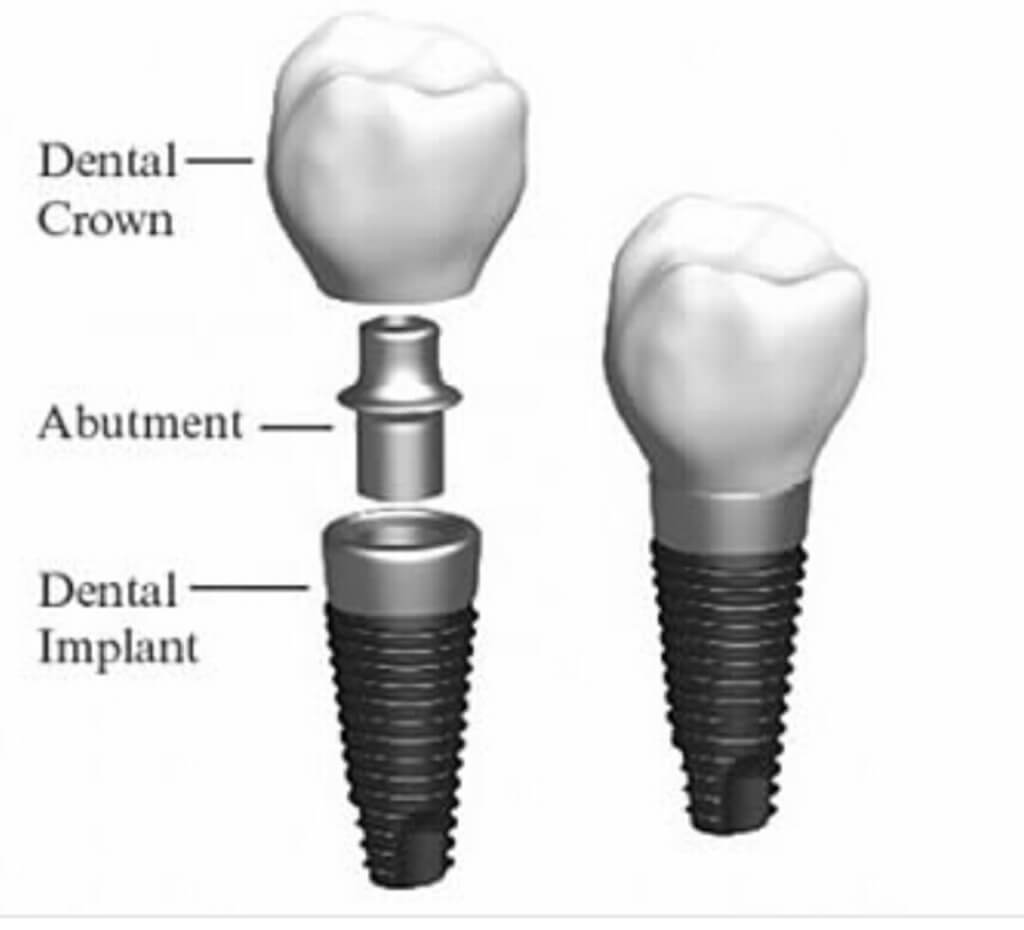 Clearwater FL Periodontist Dr. Todd Britten Discusses Are all dental