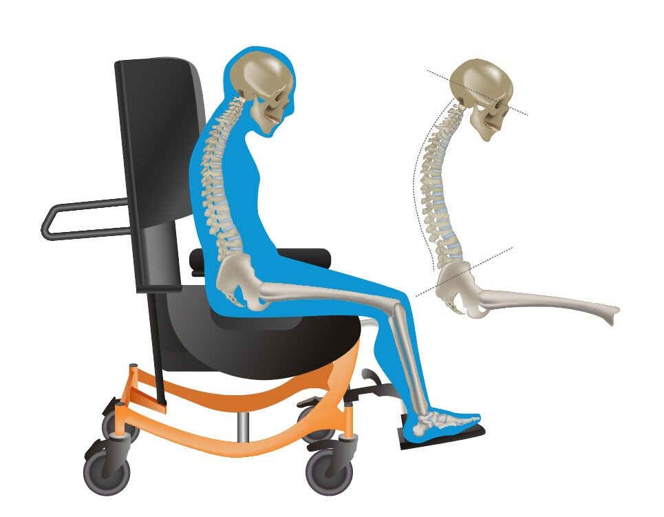 Abnormal Postures & Wheelchair Seating Broda