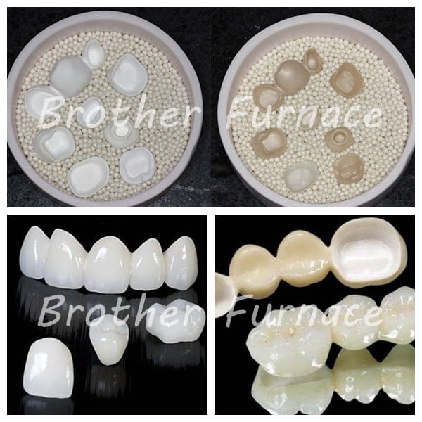 Dental Zirconia Sintering Furnace for Good Dentures Brother Furnace