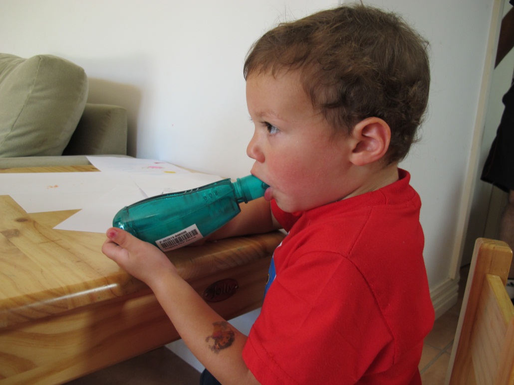 Acapella Bronchiectasis