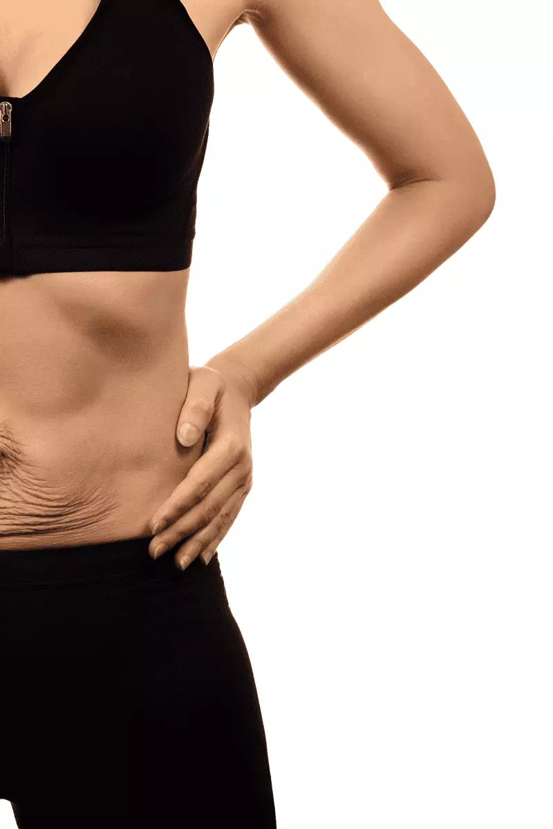 Diastasis Recti Inspira Physical Therapy and Pilates