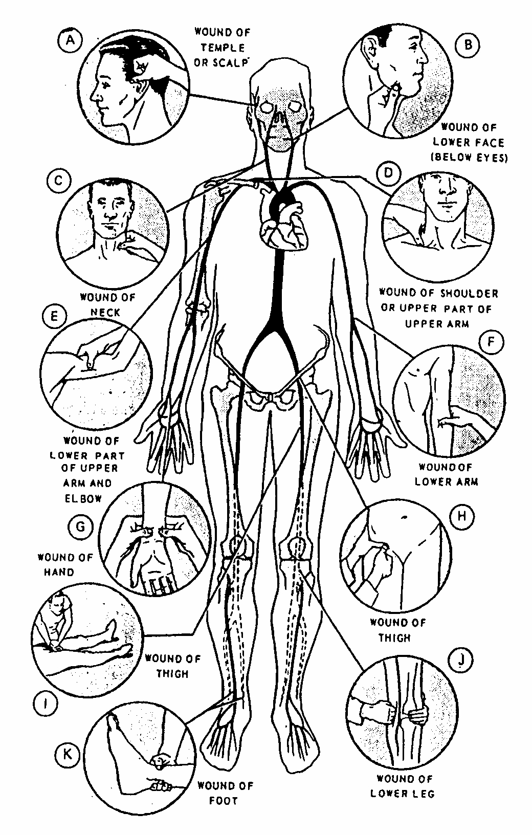 Figure 210. Locations of pressure points. Tactical
