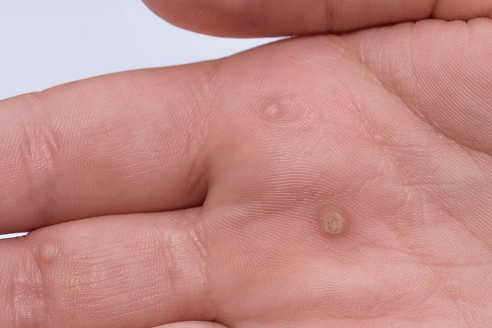 Medical Dermatology Skin Conditions We Treat