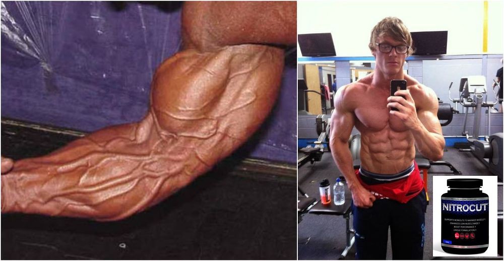 nitric oxide Archives