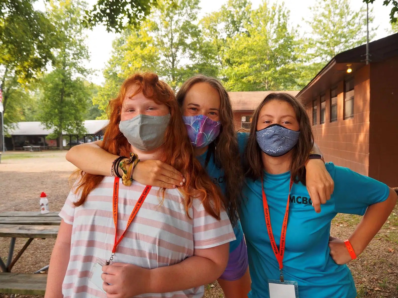 Midwest Children's Burn Camp Burns Recovered