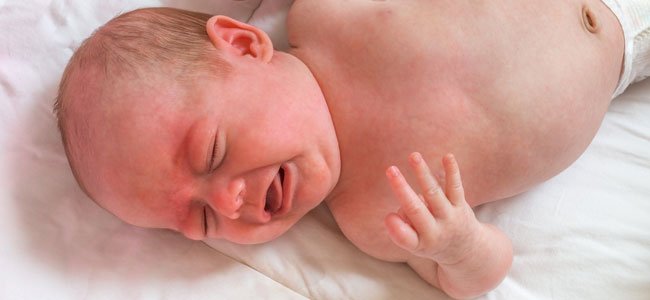 Crianças e bebês com Escarlatina