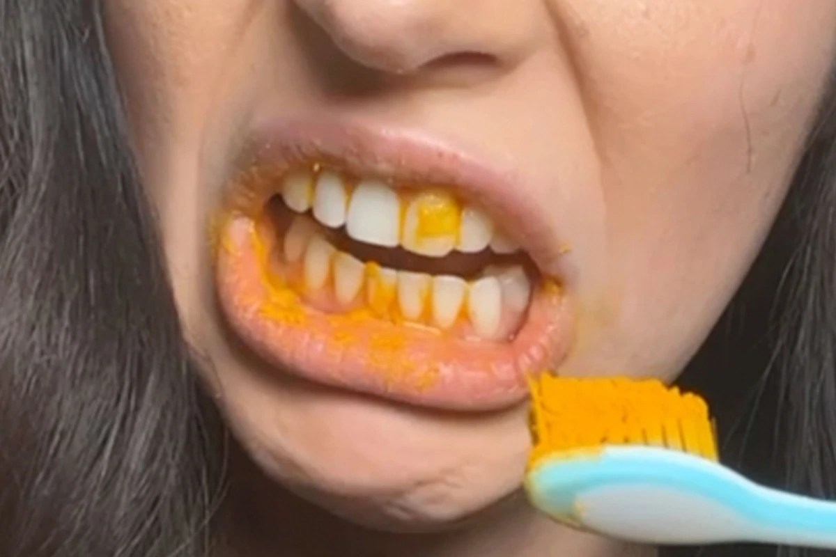 Can Turmeric Stain Teeth? A Closer Look At Its Benefits For Oral Health Top Globe News