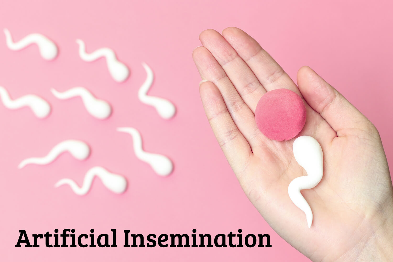 Artificial Insemination – Process, Pros and Cons - Being The Parent