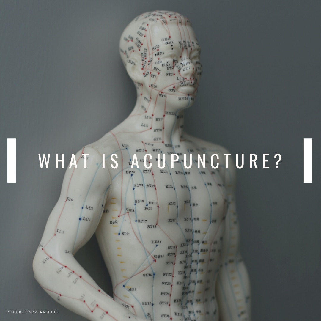 What is Acupuncture? Bucks County Acupuncture Clinic