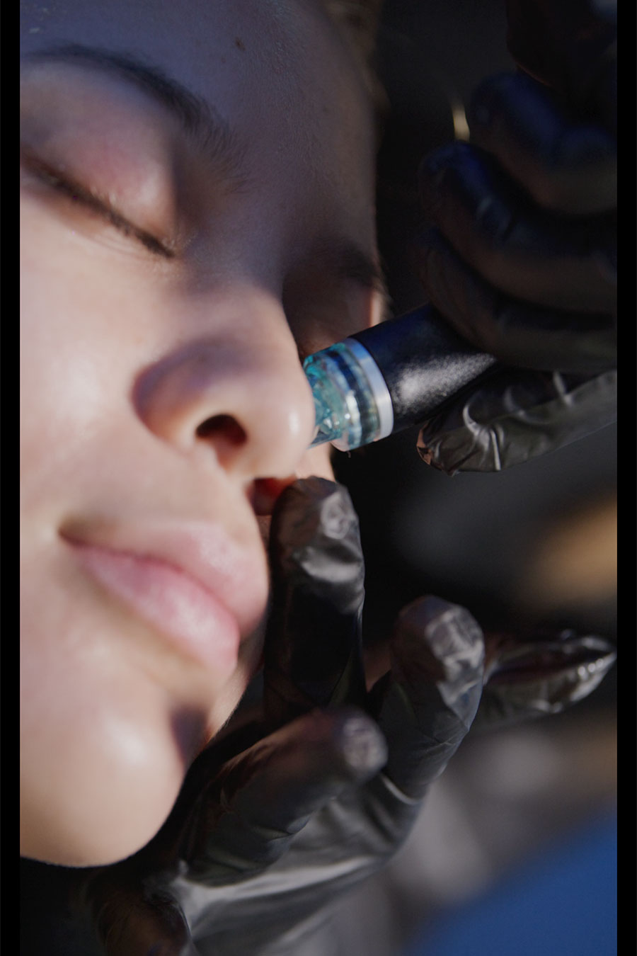 HydraFacial Treatment Buffalo, NY Buffalo Regenerative Medicine