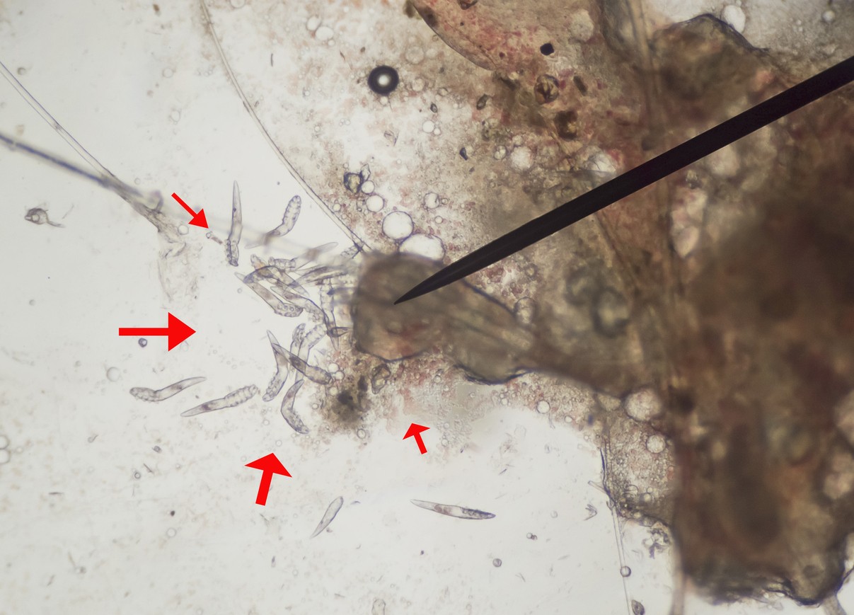 Do Demodex Mites Live On Bedding at Barbara Jennings blog