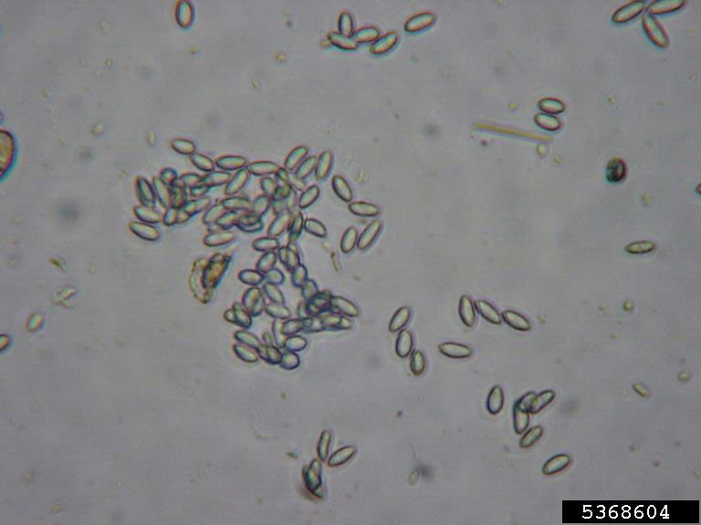 grape anthracnose (Elsinoe ampelina ) on grape (Vitis spp. ) 5368604