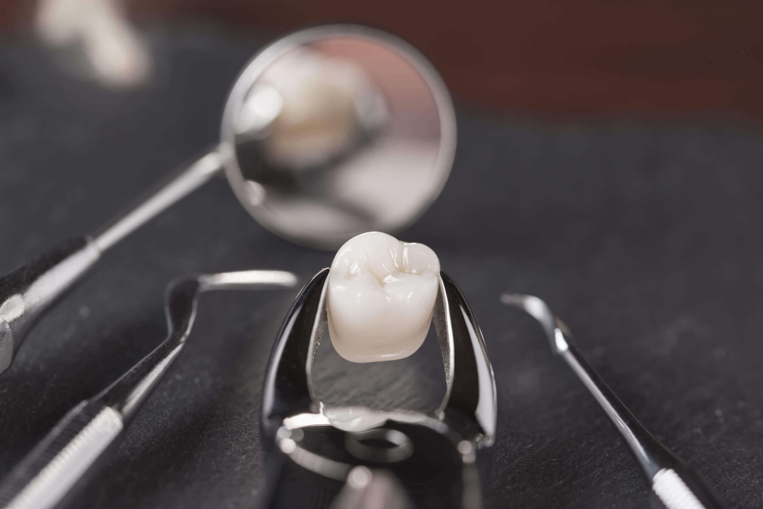 Do You Need a Tooth Removed? Artistic Touch Dentistry