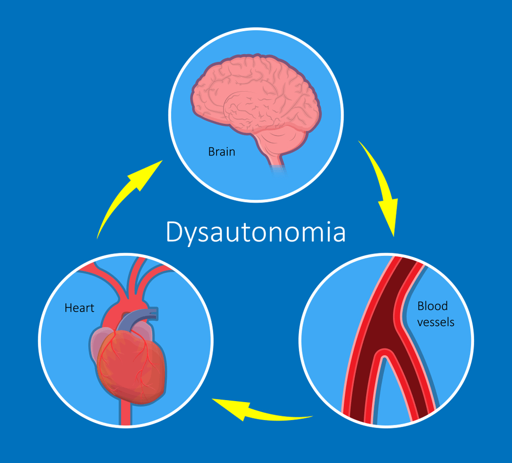 Dysautonomia Disorders Of the Autonomic Nervous System