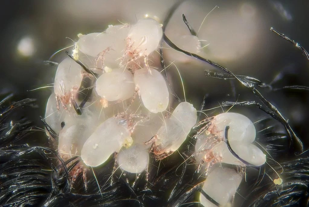 Exploring The Reality Of Dust Mite Bites