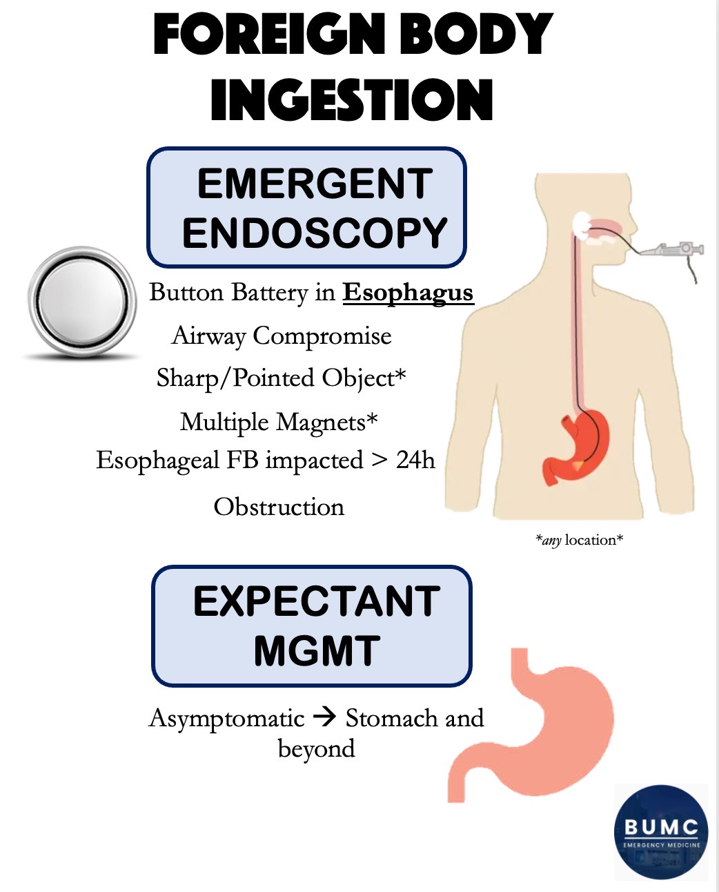 Foreign Body Ingestion 2 BUMCEM