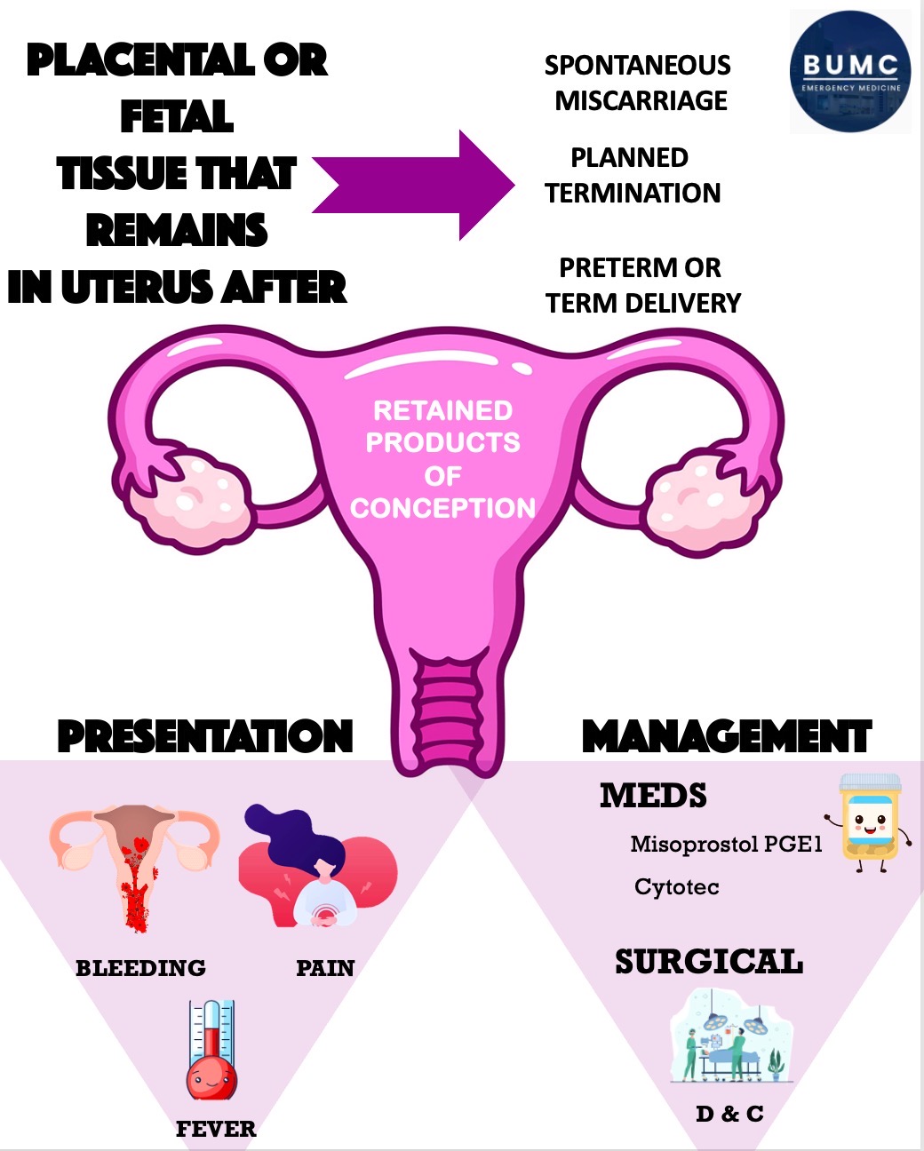 Retained Products of Conception BUMCEM