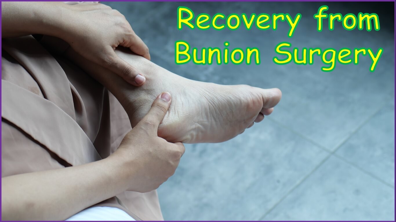 Road to Happy Feet Navigating Recovery from Bunion Surgery