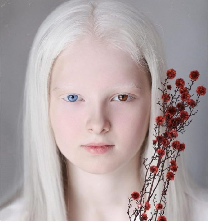 Conosci una delle albine più belle ed uniche al mondo lei ha gli occhi