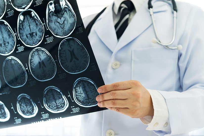 Head Injury Vs. Brain Injury & Williams