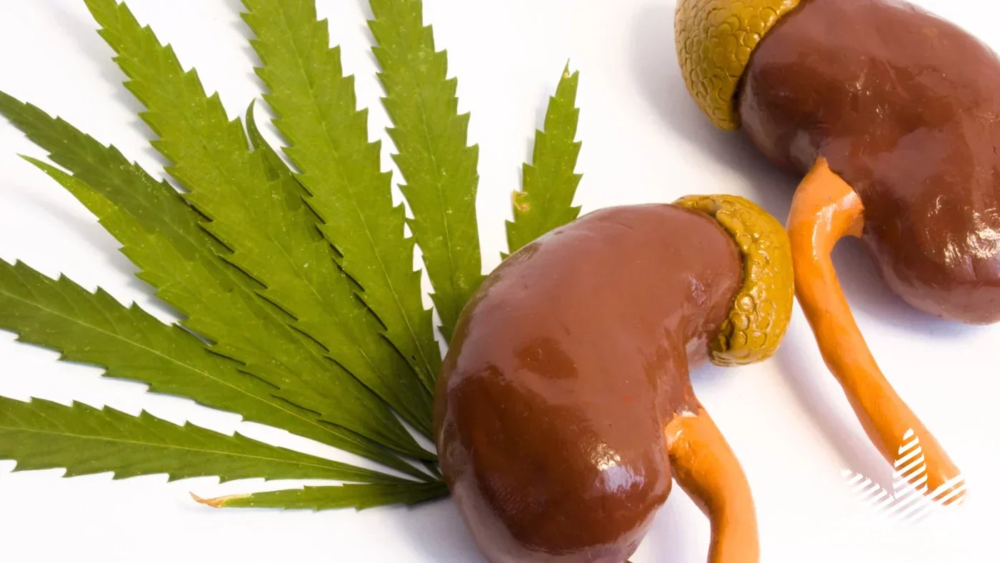CBD Oil Uncovering the Benefits and Side Effects on Kidneys Burning