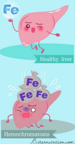 18 Signs of Iron Overload and Hereditary Hemochromatosis (plus, what tests you'll want to take) | Butter Nutrition